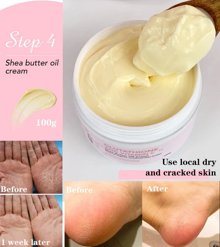 AILKE Whitening Skin Care Cream, Lightening Lotion, Remove Dark Spots With Glutathion, Shea Butter, Moisturizing Body Cream