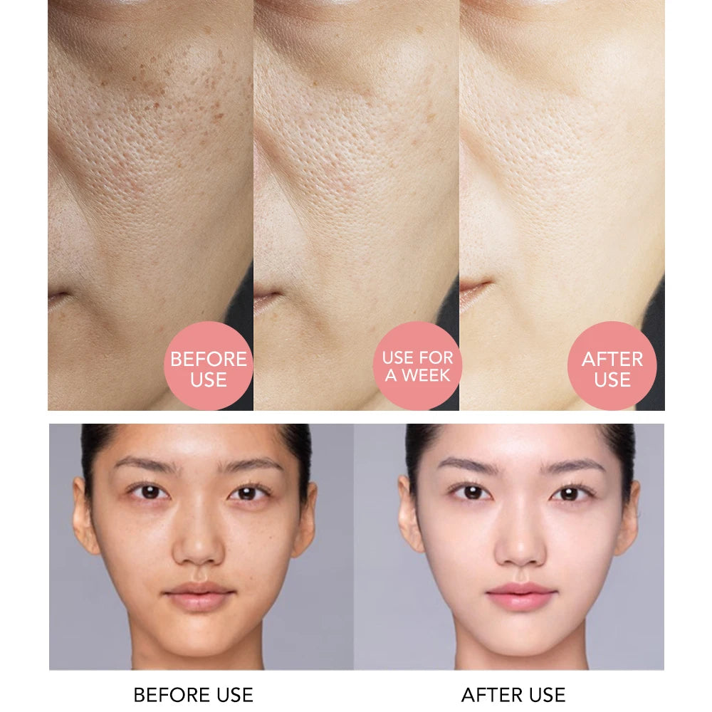 AILKE Collagen Whitening Face Care Set, Moisturizing, Even Skin Tone, Reduce Dark Spots, With Hyaluronic Acid, Vitamin E