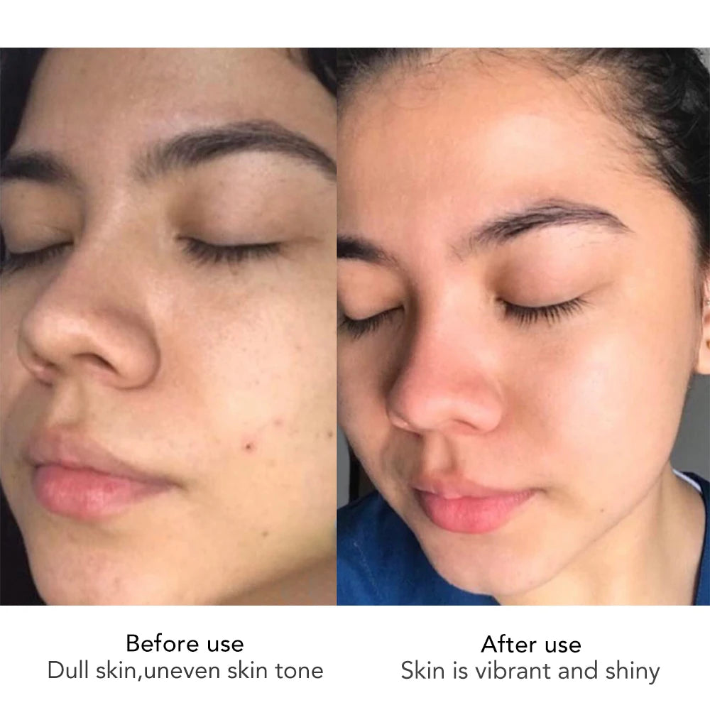 AILKE Skin Radiant Facial Cream With Sodium Hyaluronate, Lightening, Moisturizing, Cleansing, Improve Dull Skin Face Cream