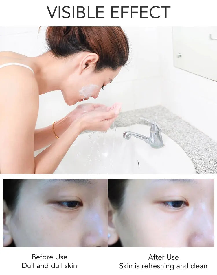 AILKE Whitening Dark Spots Remove Facial Skin Care Cream With Collagen, Reduce Freckles, Wrinkles, Women Premium Face Product