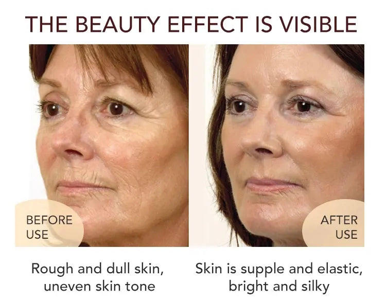 AILKE Whitening Dark Spots Remove Facial Skin Care Cream With Collagen, Reduce Freckles, Wrinkles, Women Premium Face Product