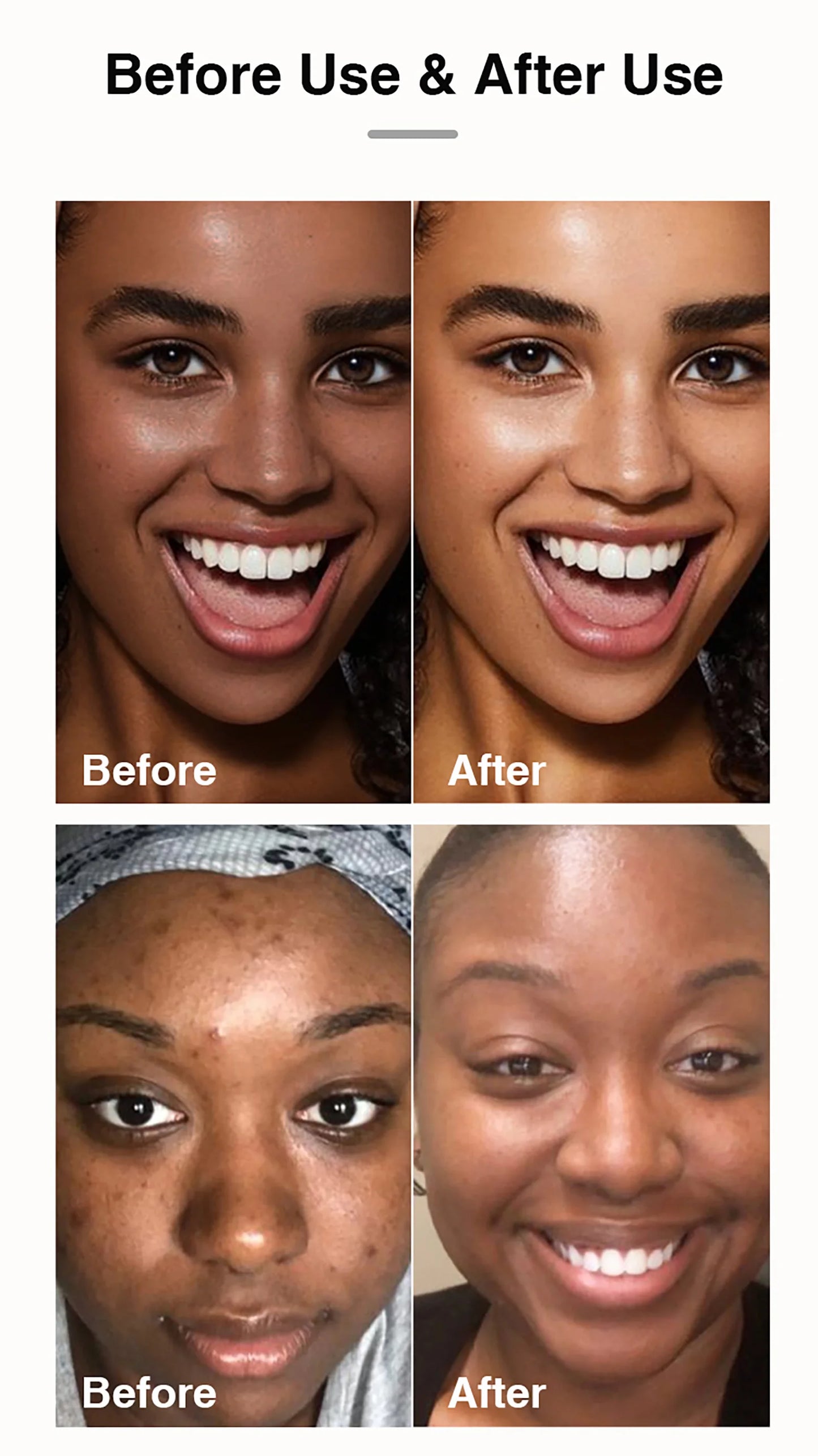 AILKE Natural Turmeric Skin Care Range, Lightening, Cleaning Skin, Moisturizes, Remove Acne and Pimples, Refining Pores