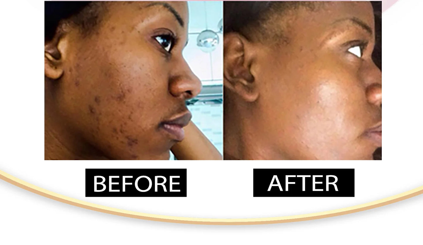 AILKE Skin Whitening Face Serum, Reduce Spots, Moisturizing, Even Skin Tone, With Organic Collagen, Skin Lightening Body Serum