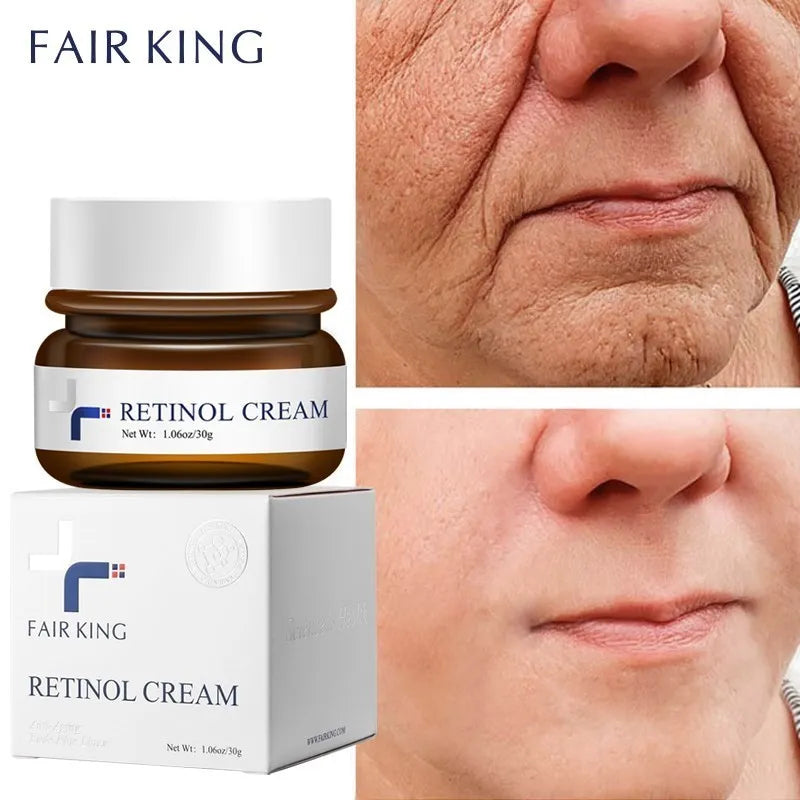 FAIRKING Retinol Anti-Aging Face Cream Reduces Wrinkles and Smoothes Rough Skin Face Skin Care Increase Skin Elasticity 30g