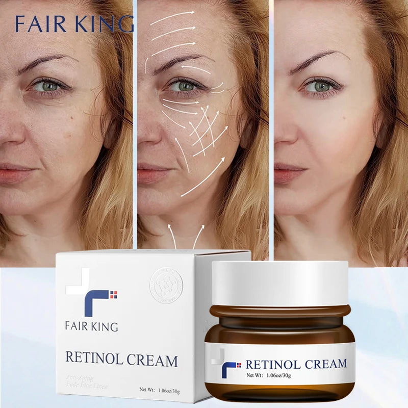 FAIRKING Retinol Anti-Aging Face Cream Reduces Wrinkles and Smoothes Rough Skin Face Skin Care Increase Skin Elasticity 30g