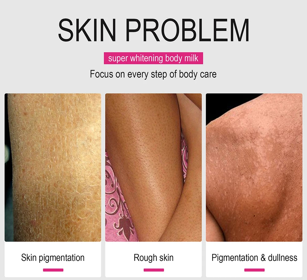 AILKE Whitening Body Lotion for Bright & Healthy Skin - Effective Skin Care Solution - Enhances Radiance & Evens Skin Tone