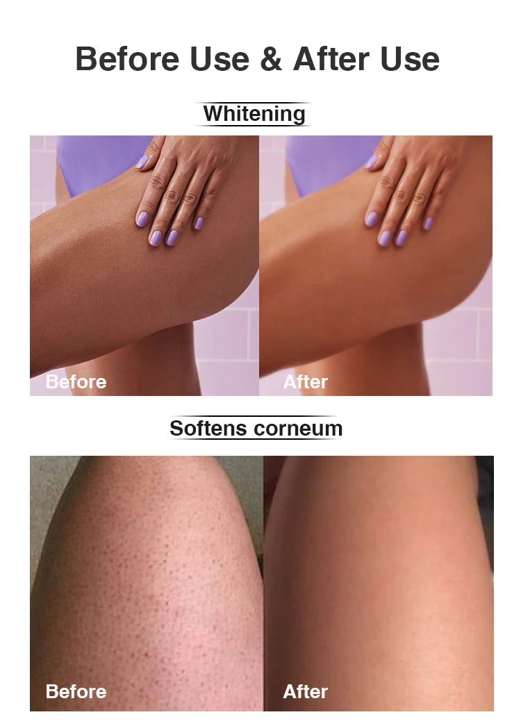 AILKE Brightening Skin Care Set, Reduce Dark Spots, Acne, Moisturizing, Nourishing and Smooth Skin, Non-Greasy, Absorb Instantly