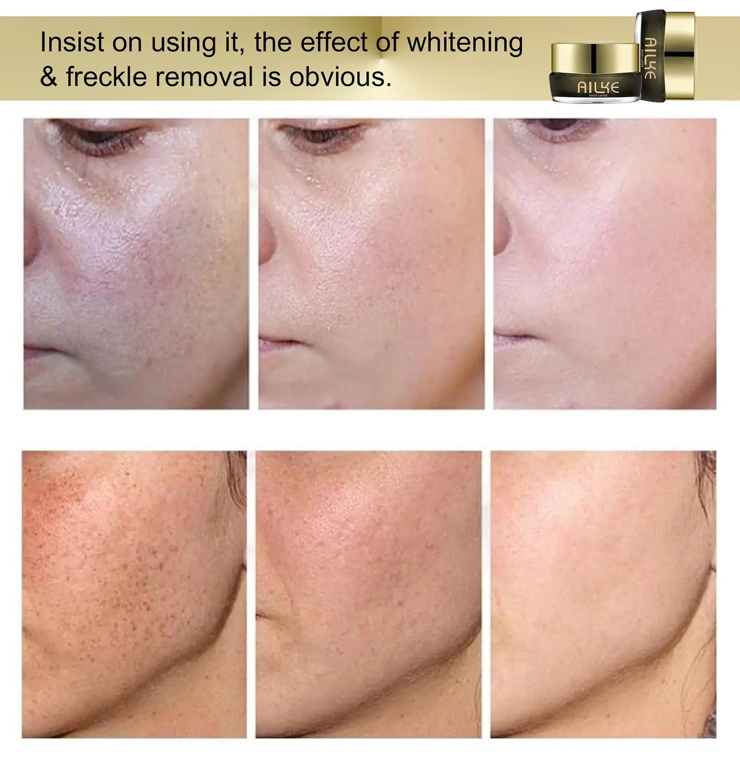 AILKE Lightening Facial Cream, Brightening, Reduce Spots, For Black and Dark Skin, Whitening Face Care Set for All Skin Types