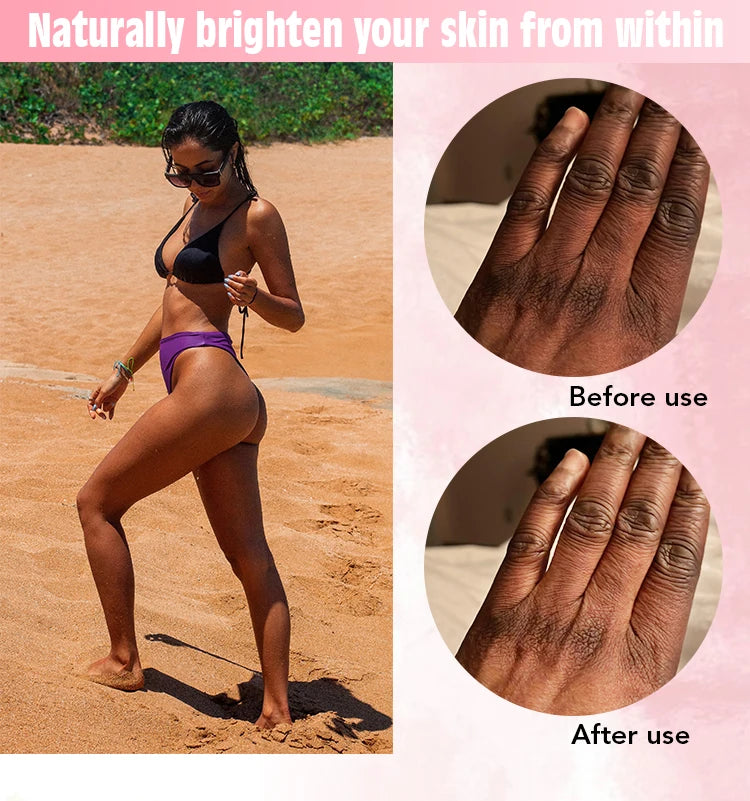 AILKE Whitening Skin Care Cream, Lightening Lotion, Remove Dark Spots With Glutathion, Shea Butter, Moisturizing Body Cream