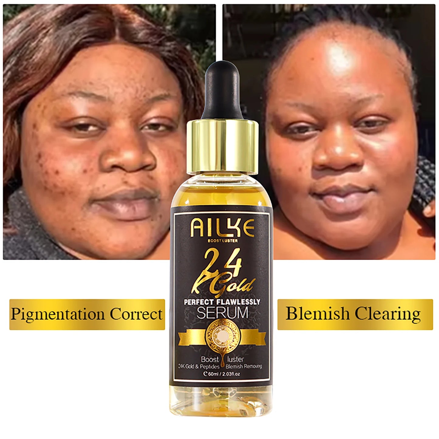 AILKE 24K Gold Perfect Flawlessly Lightening Skin Care Kit, Moisturizing, Smooth Skin, Even Skin Tone, Reduce Wrinkles