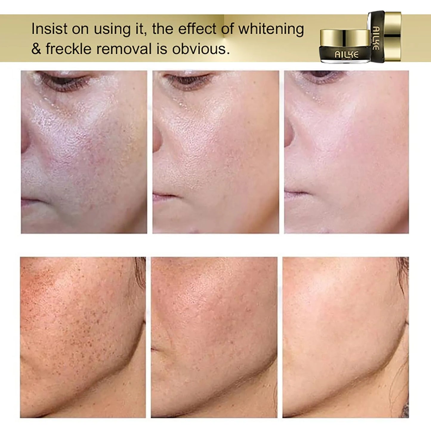 AILKE Collagen Whitening Face Care Set, Moisturizing, Even Skin Tone, Reduce Dark Spots, With Hyaluronic Acid, Vitamin E