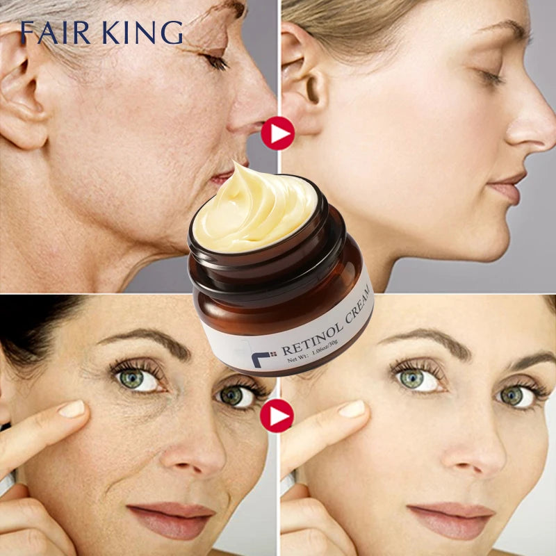 FAIRKING Retinol Anti-Aging Face Cream Reduces Wrinkles and Smoothes Rough Skin Face Skin Care Increase Skin Elasticity 30g