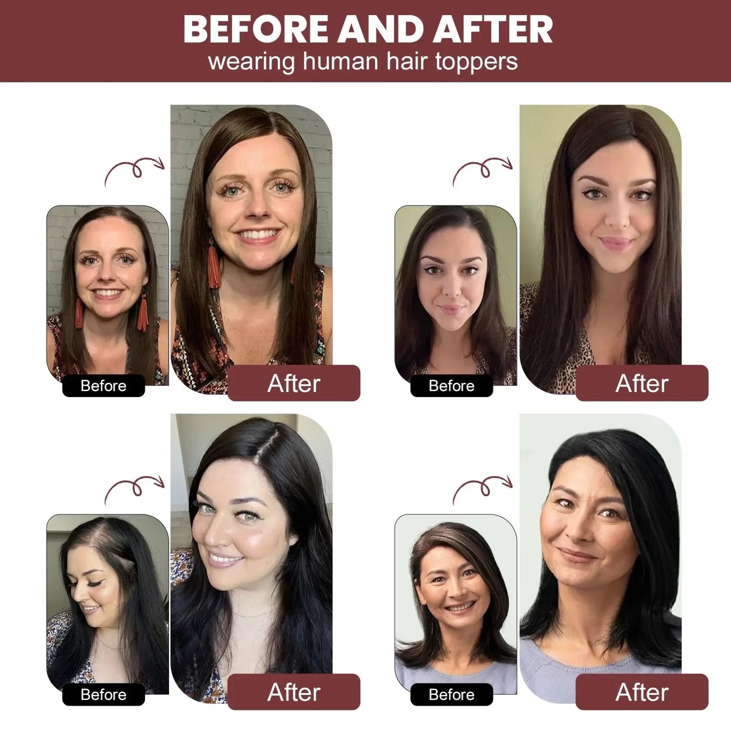 Black Brown Color Topper With Clips 3 Sizes Silk Base Virgin Human Hair Women Toppers Free Part Natural Scalp Top European Hair