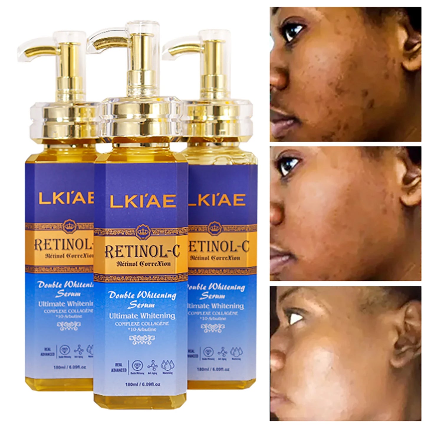 LKIAE Retinol Whitening Skin Care Set, Moisturizing, Reduce Wrinkles, Fine Lines, Dark Spots, With Collagen, Snail Extract