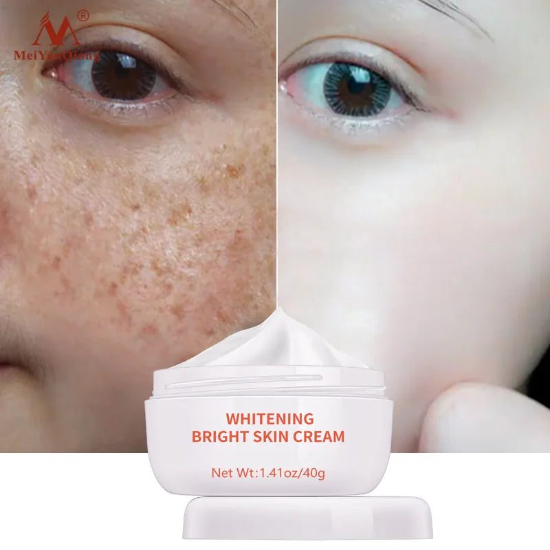 Moisturiser Face Whitening Freckle Cream Remove Acne Spots Melanin Dark Spots Face Lift Firming Face Skin Care Bright Skin Cream