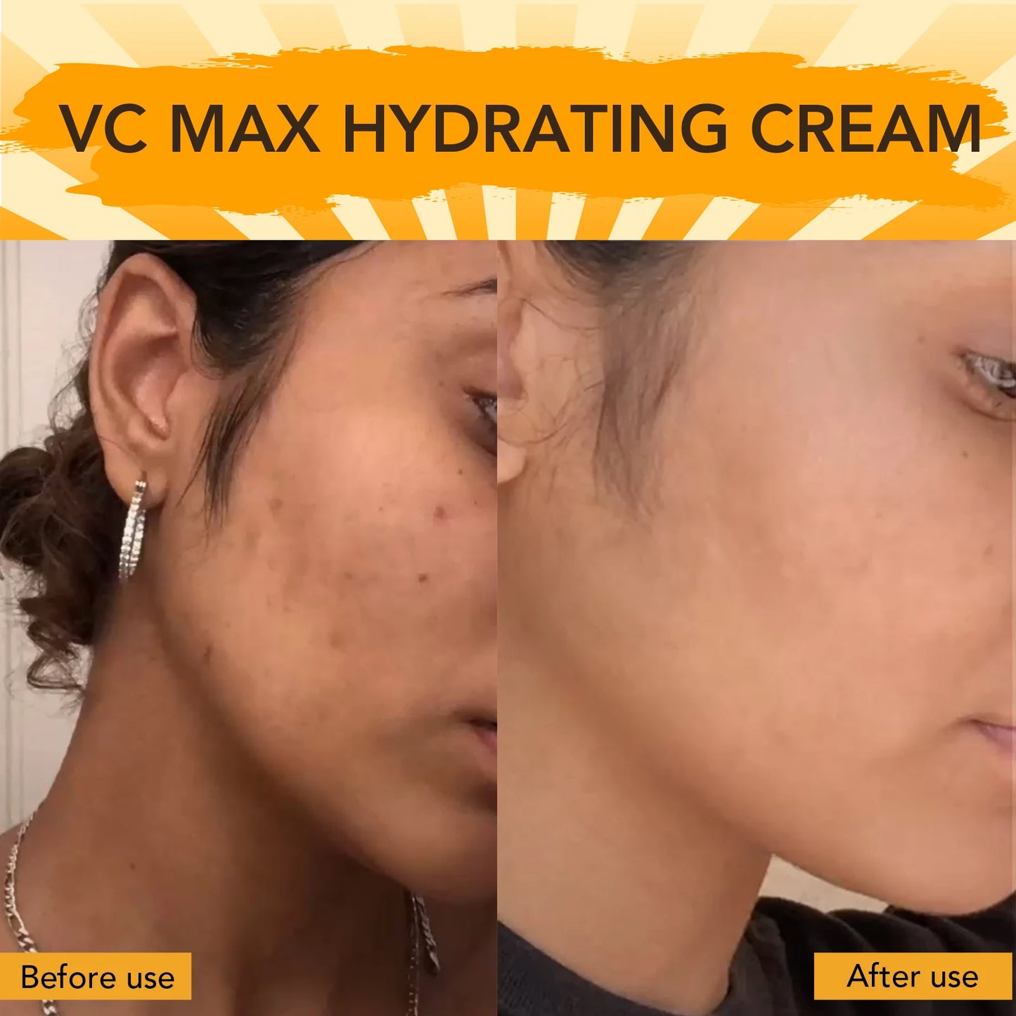 AILKE Brightening Body Cream, with Vitamin C, Hyaluronic Acid, Clean Skin, Even Skin Tone, Smooth, Skin Glowing Range for Women