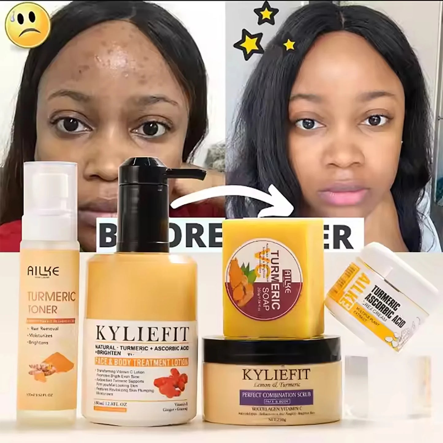 AILKE Natural Turmeric Skin Care Range, Lightening, Cleaning Skin, Moisturizes, Remove Acne and Pimples, Refining Pores