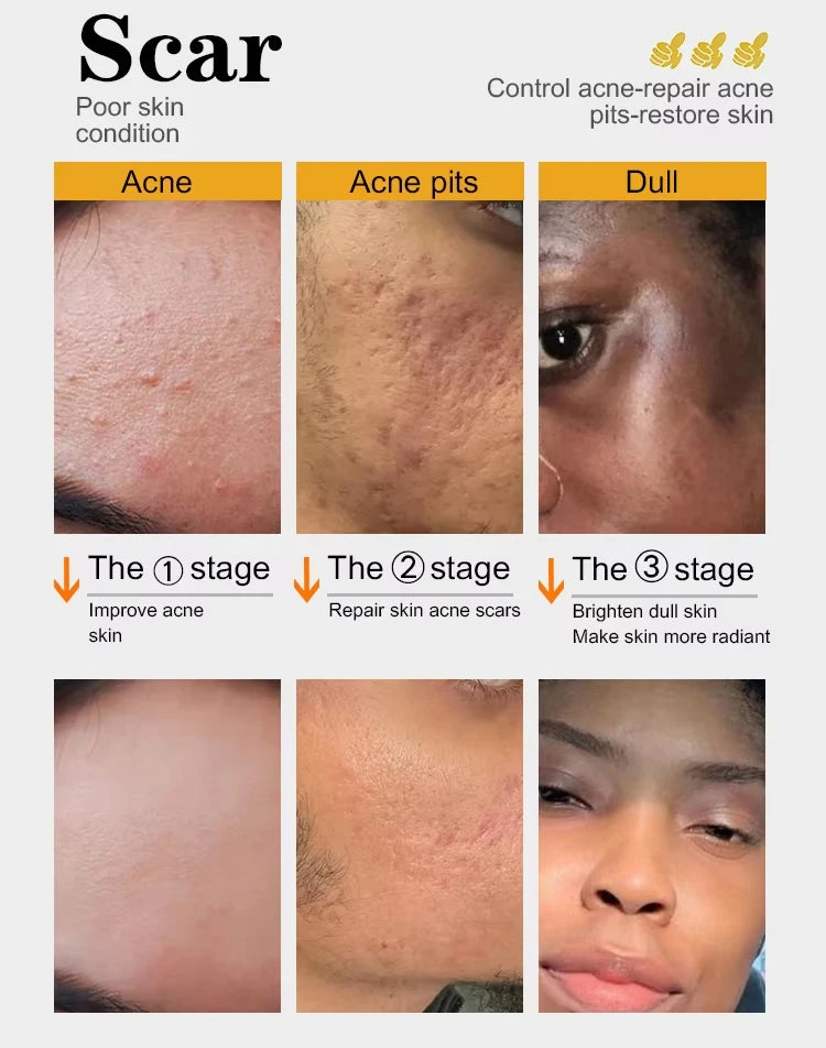 Organic Turmeric Skin Care Kit, Brighten, Remove Darkness, Spots, Acne, Lighten, Hydration, Exfoliate, Even Skin Tone,