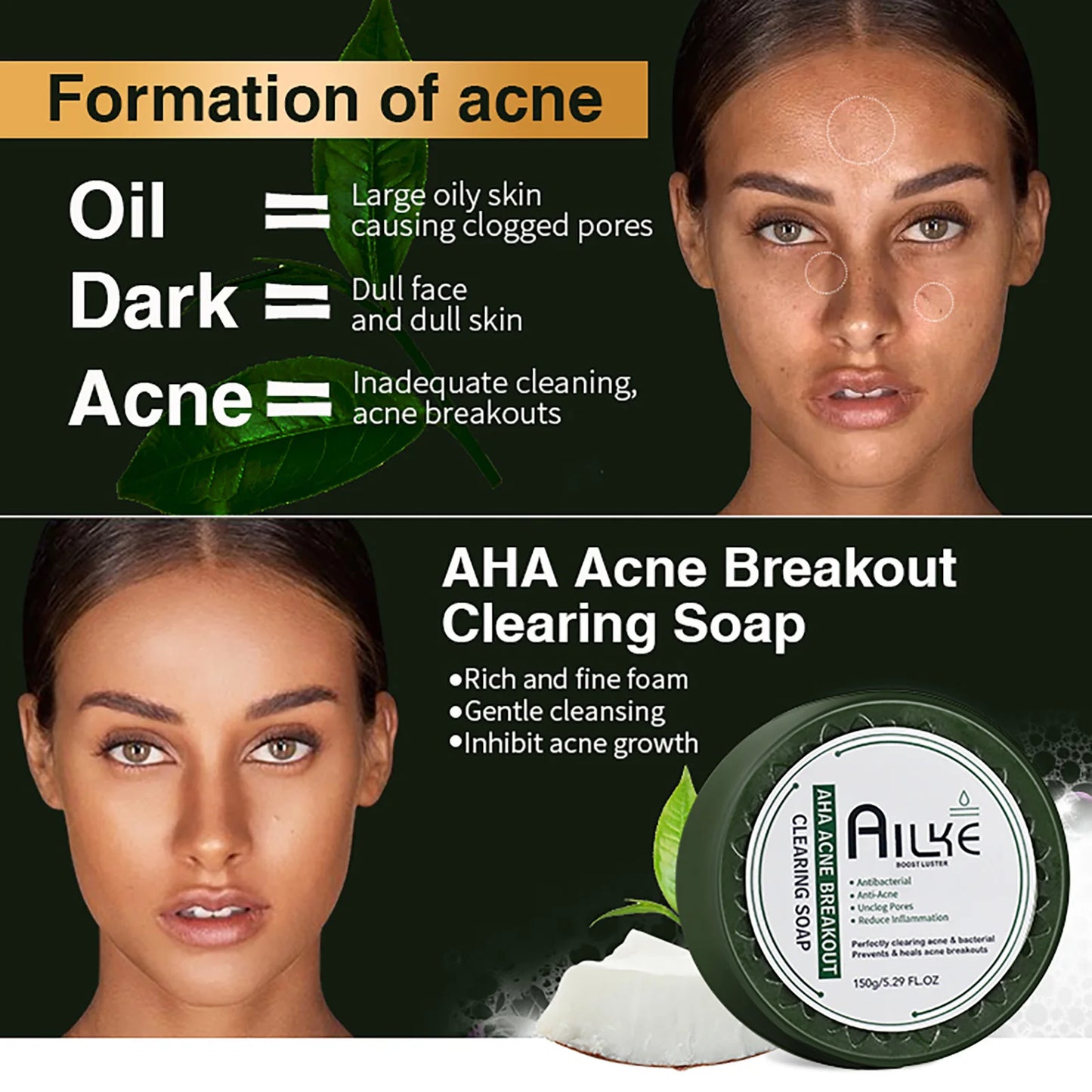 AILKE Organic Anti-Acne Cleansing Face Care Set, Smooth Skin, Reduce Pimples, Spots, Prevent Breakout
