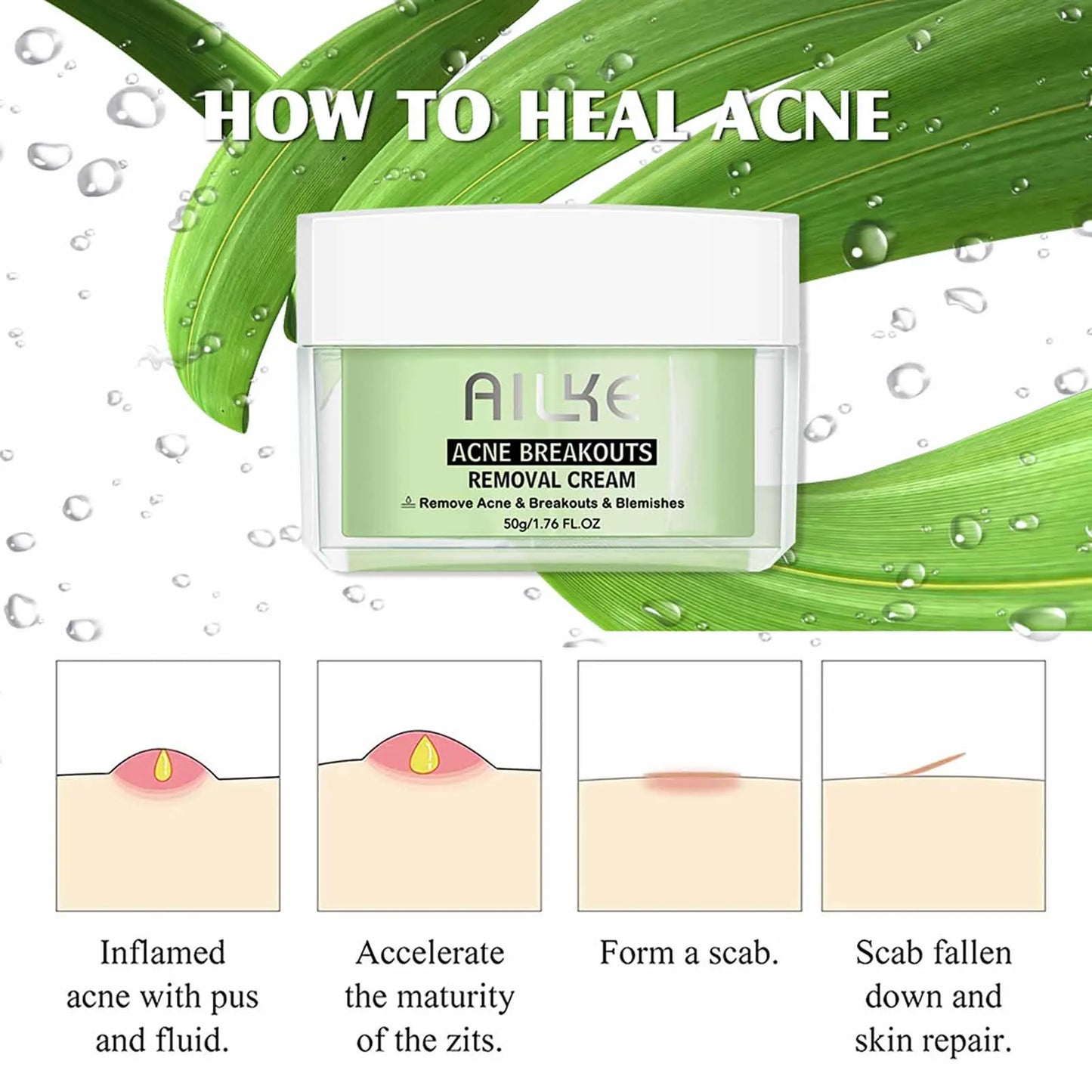 AILKE Organic Anti-Acne Cleansing Face Care Set, Smooth Skin, Reduce Pimples, Spots, Prevent Breakout