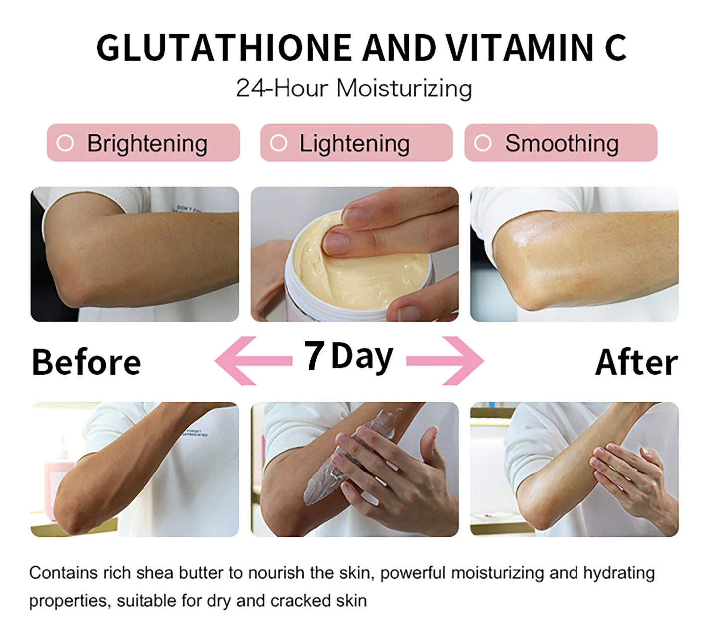 AILKE Whitening Skin Care Cream, Lightening Lotion, Remove Dark Spots With Glutathion, Shea Butter, Moisturizing Body Cream