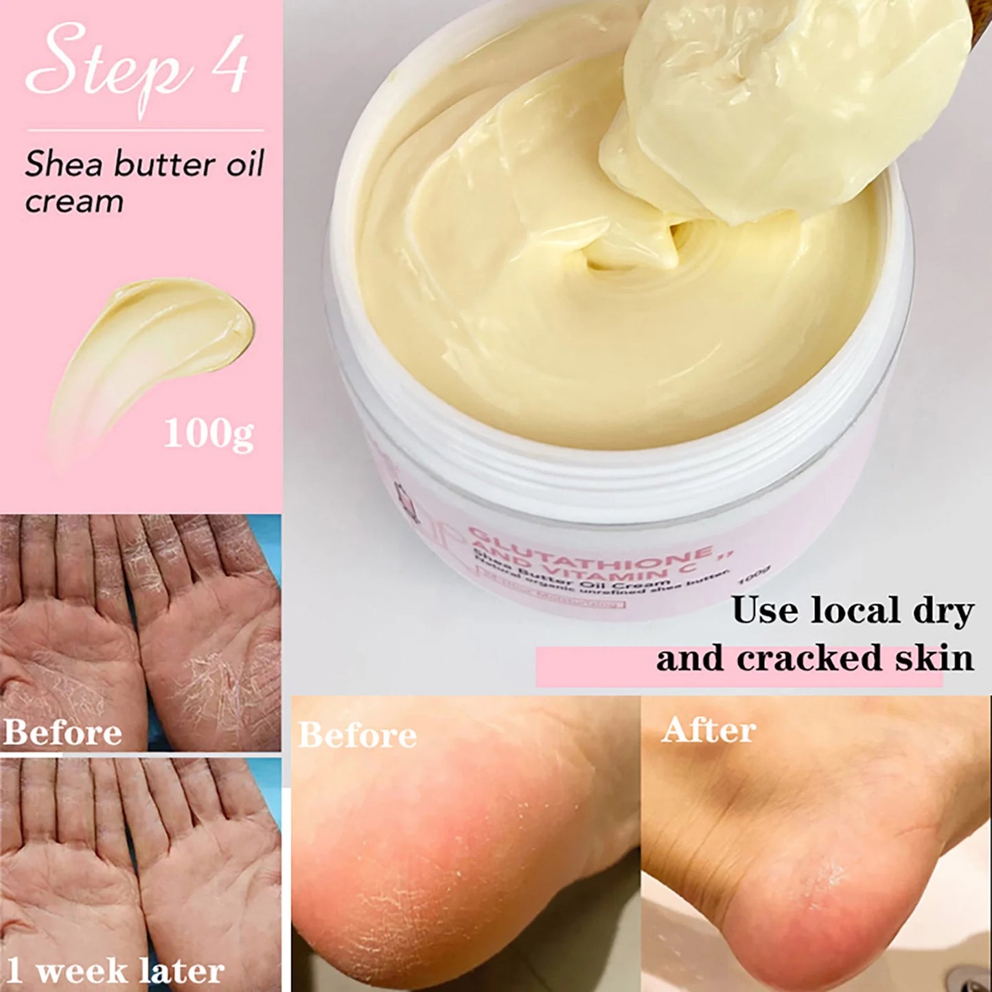 AILKE Whitening Skin Care Cream, Lightening Lotion, Remove Dark Spots With Glutathion, Shea Butter, Moisturizing Body Cream